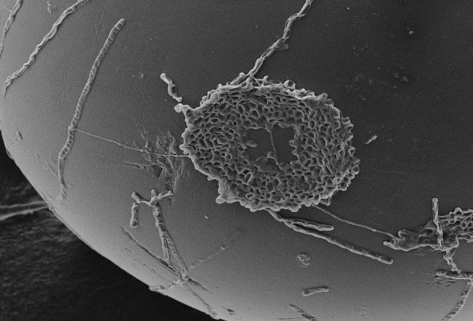 500 micron Resin Bead Bacteria Fouling