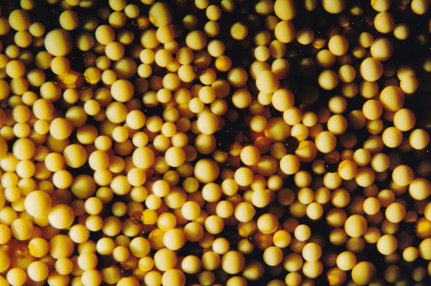 Photo 4 - 40 x Magnification Macroporus Anion